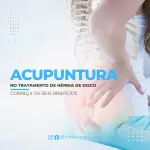Pacote de 30 Anúncios e Propagandas Editáveis no Canva para Serviços de Acupuntura