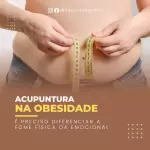 Pacote de 30 Anúncios e Propagandas Editáveis no Canva para Serviços de Acupuntura