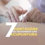 Pacote de 30 Anúncios e Propagandas Editáveis no Canva para Serviços de Acupuntura