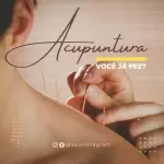 Pacote de 30 Anúncios e Propagandas Editáveis no Canva para Serviços de Acupuntura