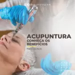 Pacote de 30 Anúncios e Propagandas Editáveis no Canva para Serviços de Acupuntura